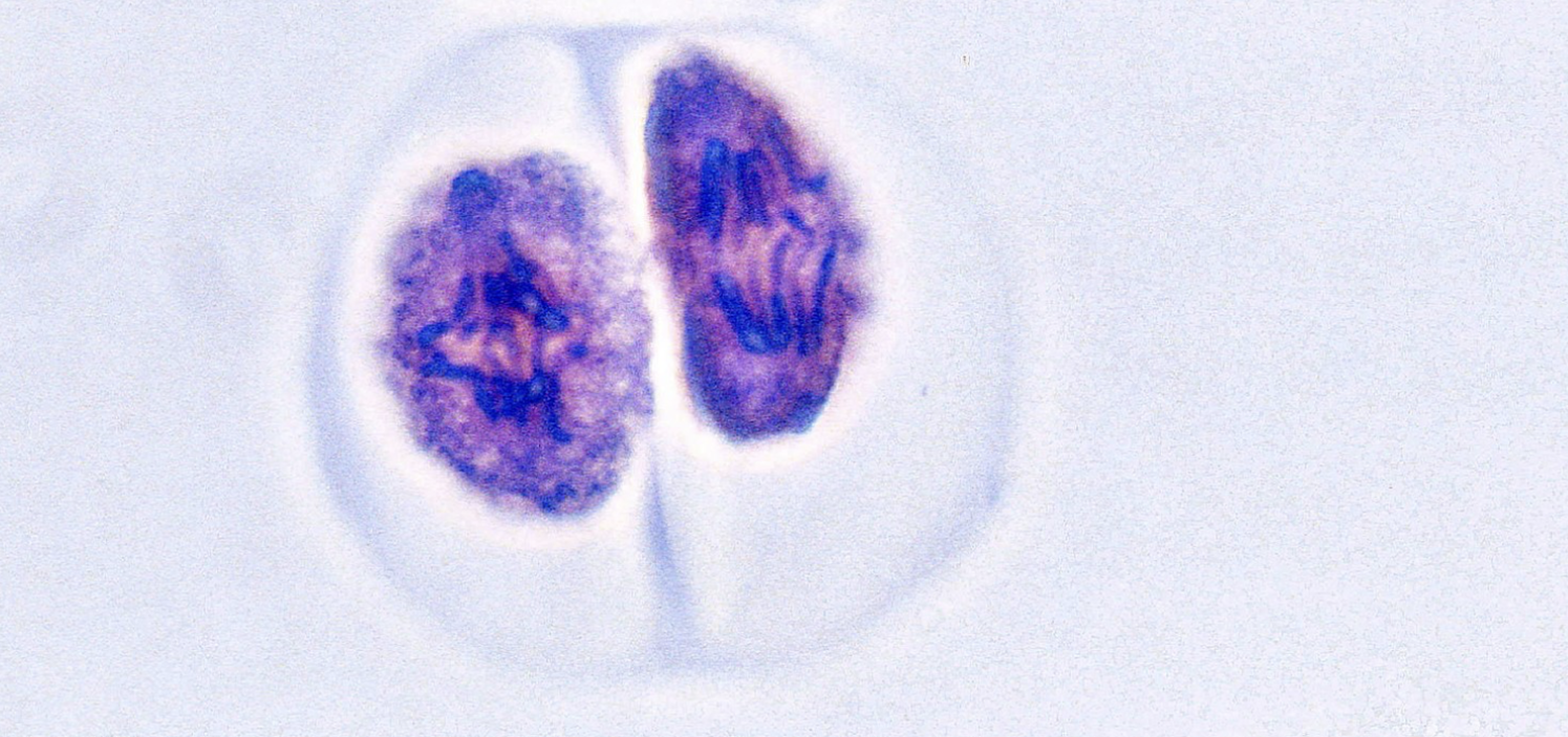 <p>what stage of cell division is this?&nbsp;</p>