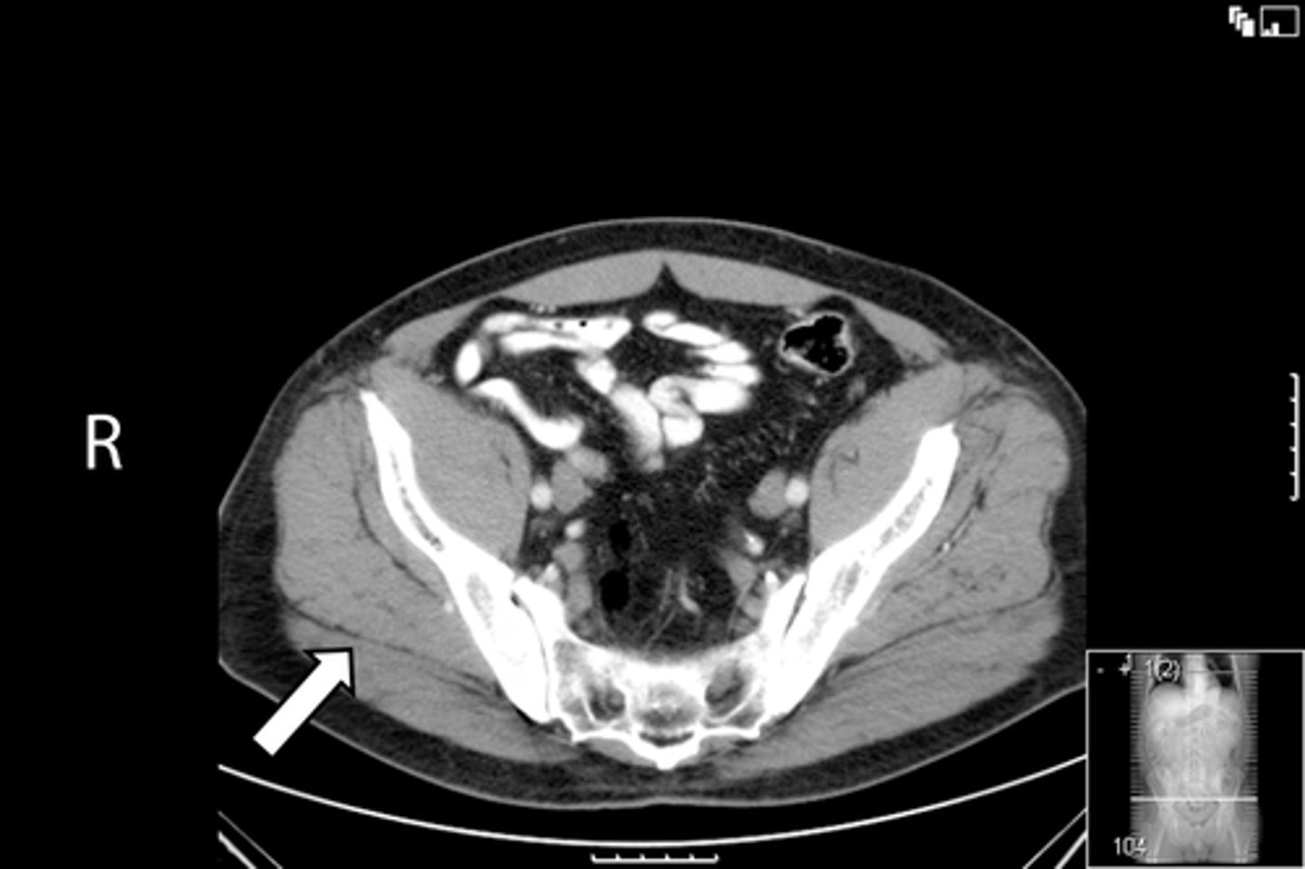 <p>What is indicated in the image?</p>