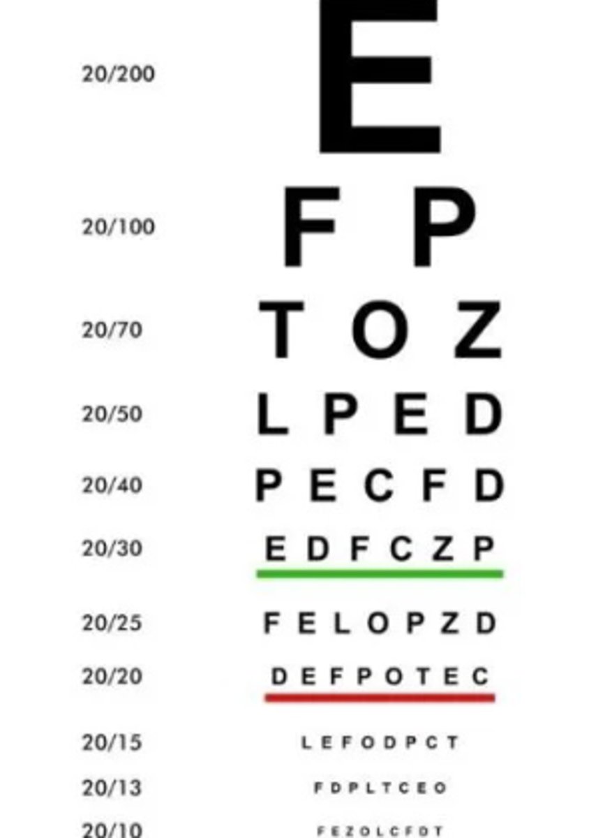 <p>The ability to distinguish between two nearby points in space (i.e., visual resolution)</p>