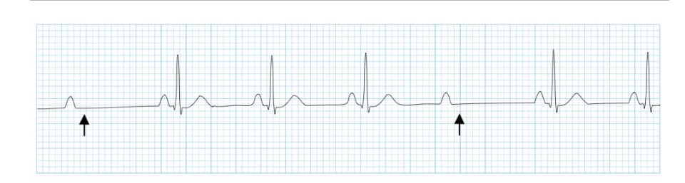 <p>Id this EKG</p>