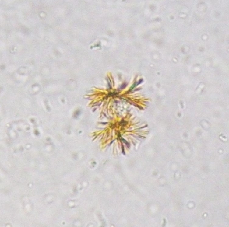 <ol><li><p>Identify structure.</p></li><li><p>What reagent strip parameter is positive when this structure is present?</p></li></ol><p></p>