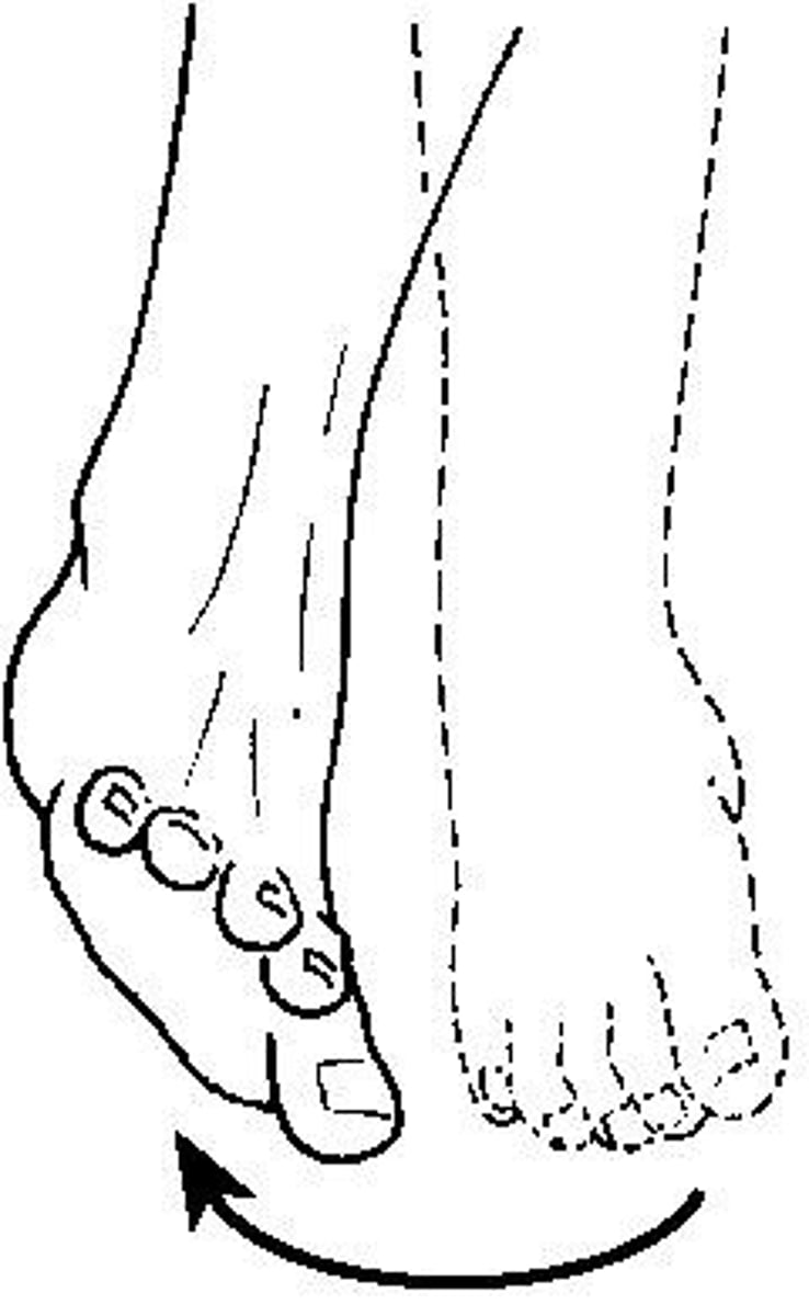 <p>Lateral rotation of the sole of the foot.</p>