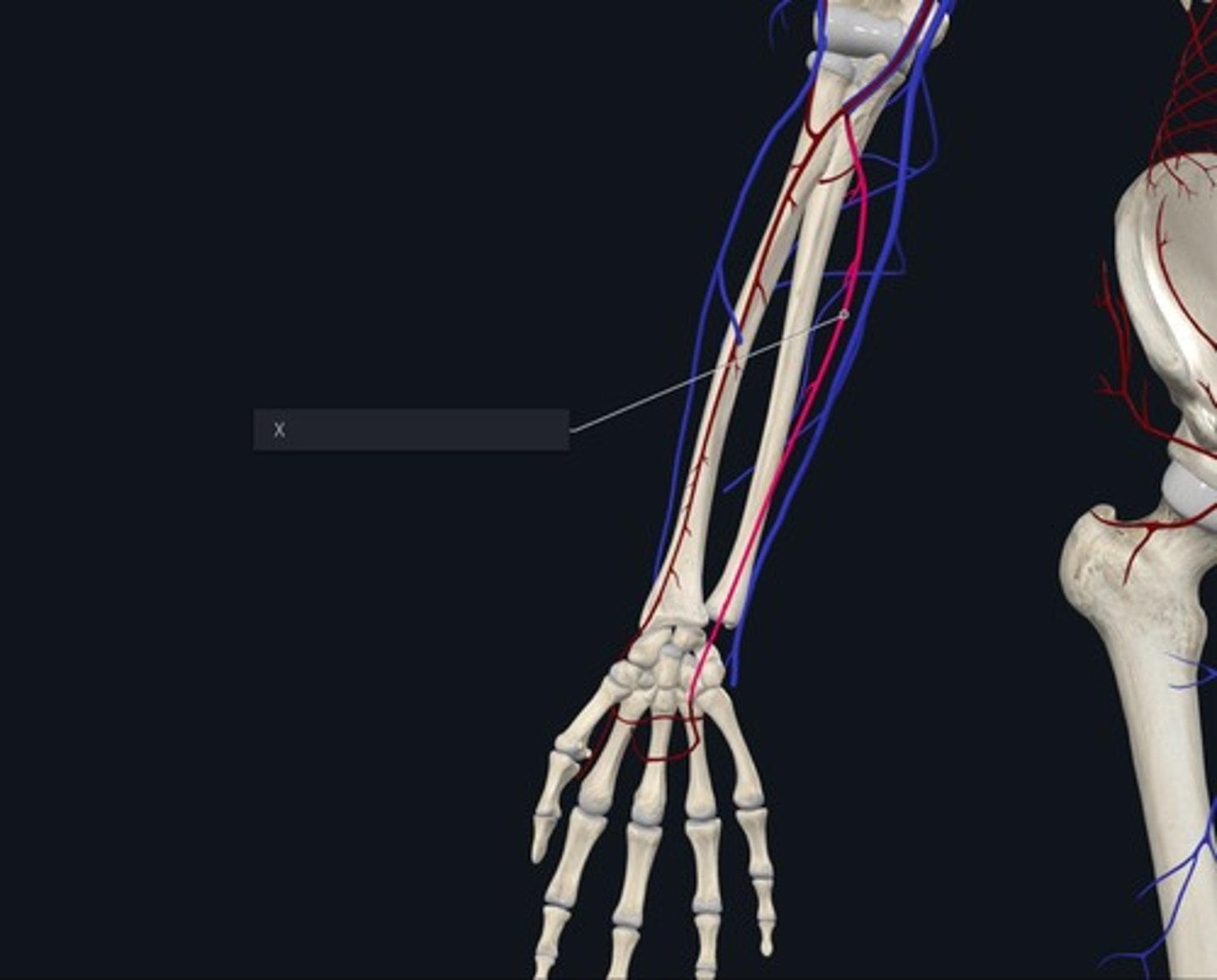 <p>Name the Vessel highlighted pink and marked with the X/ulnar side division of brachial artery</p>