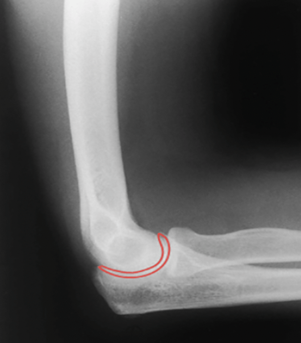<p>What structure is highlighted?</p>
