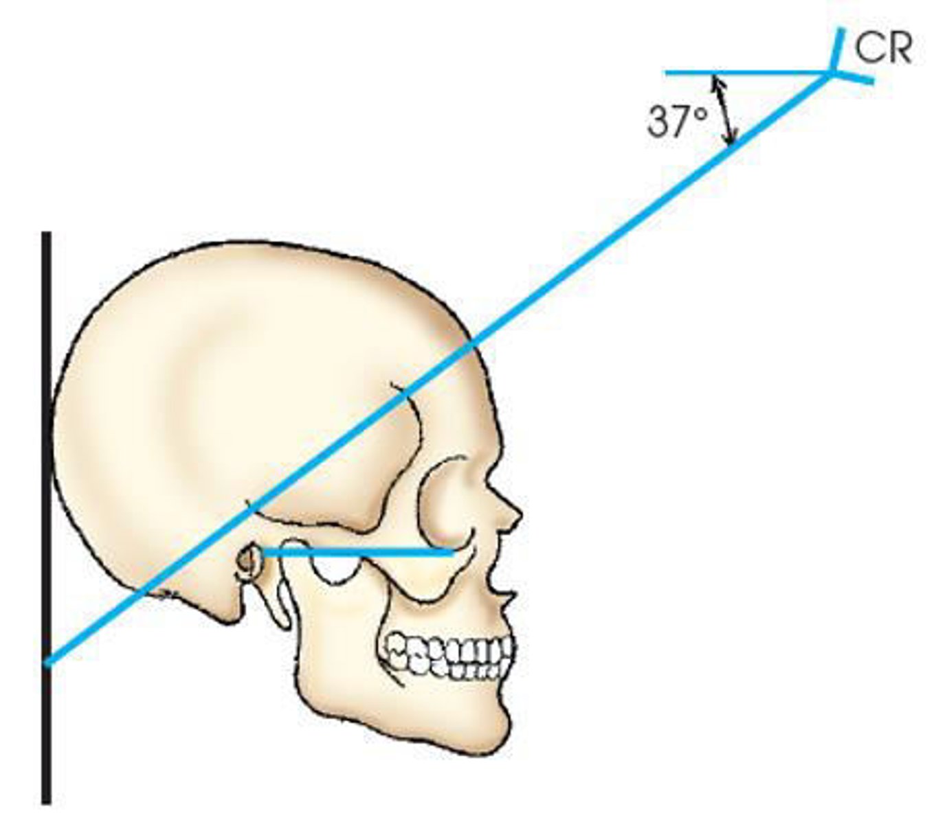 <p>b. Towne</p><p>3 multiple choice options</p>