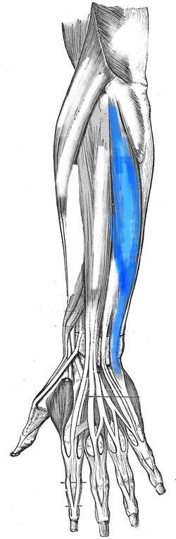 term image