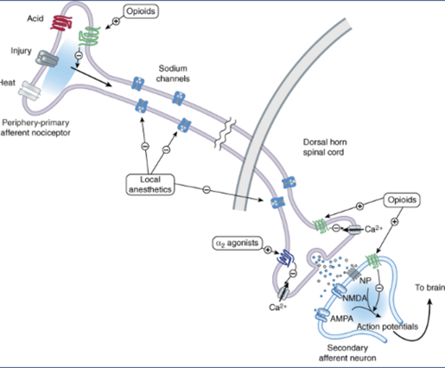 <p>-An axon with two nerve endings</p><p>-Periphery: on the skin</p><p>-Primary: first in the neural pathway</p><p>-Afferent: carrying info to a center (spinal cord)</p><p>-Nociceptor: neuron that senses pain</p><p>-Ion channels open in response to acid, injury, heat, etc.</p><p>-Voltage gated Na channels propagate APs from peripheral nerve ending to other axon terminal (dorsal horn of the spinal cord)</p>