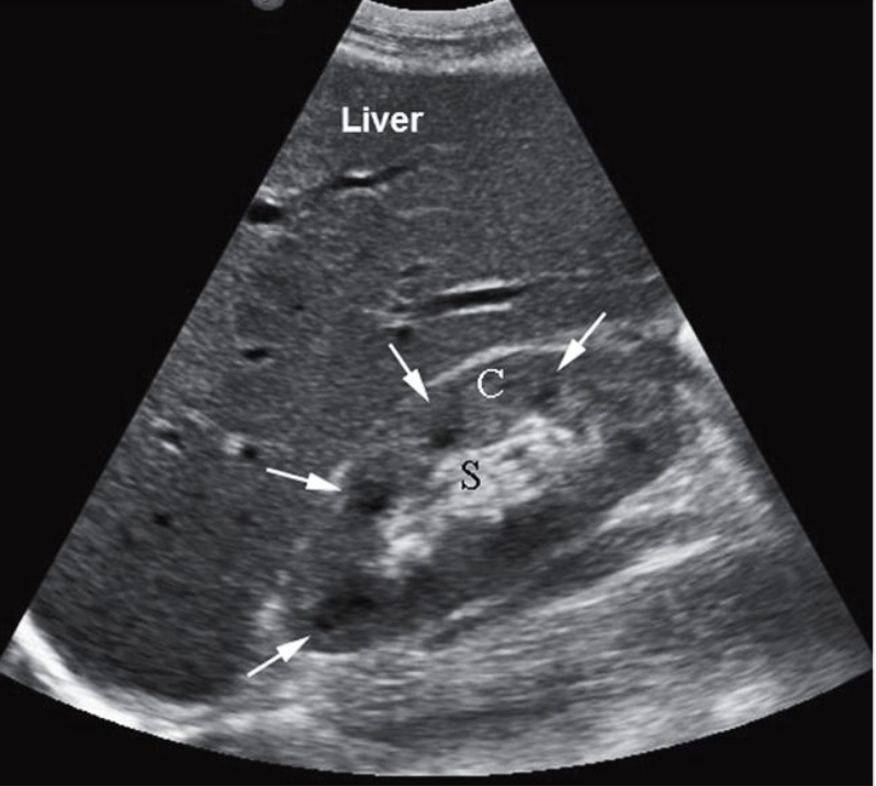 <p>Normal long kidney : C = cortex, S = sinus </p>