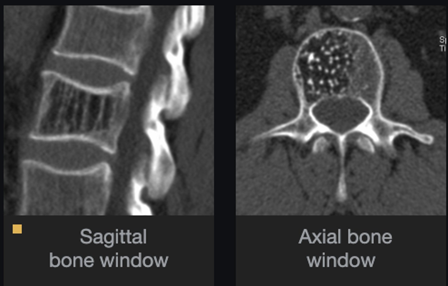 <p>Are there any distinguishing features?</p>