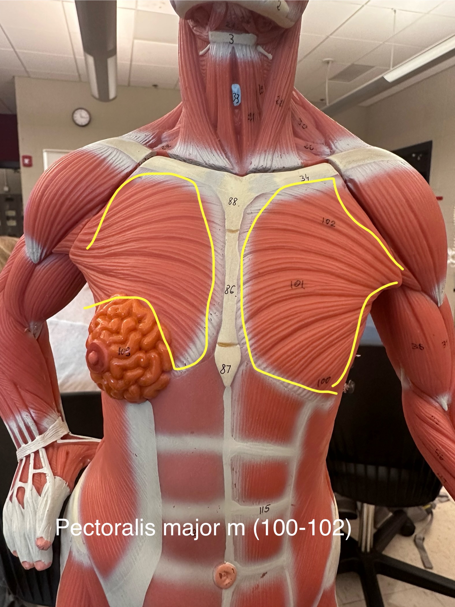 <p>Pectoralis major muscle. This muscle adducts and medially rotates the arm.</p>