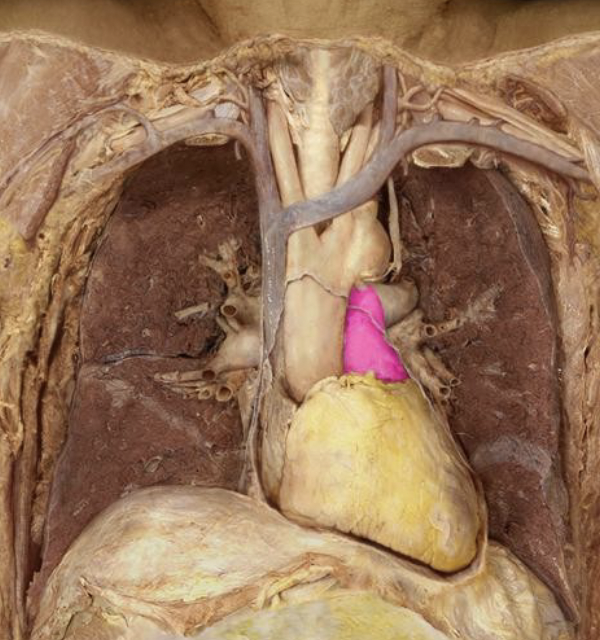 <p>what is this blood vessel that branches off the heart?</p>