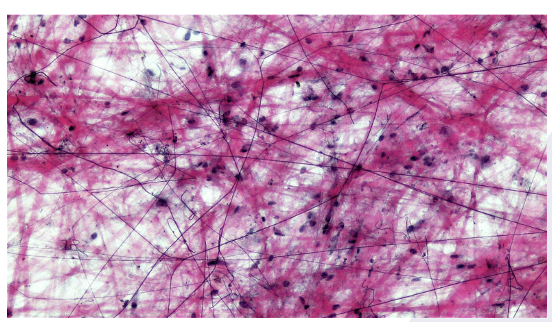 <p>Areolar Connective&nbsp;</p><p>most widely distributed </p><p>Function: Protects and Binds</p><p>Found in: Subcutaneous layer of deep skin, surrounds nerves and organs, makes up dermis of the skin&nbsp;</p>