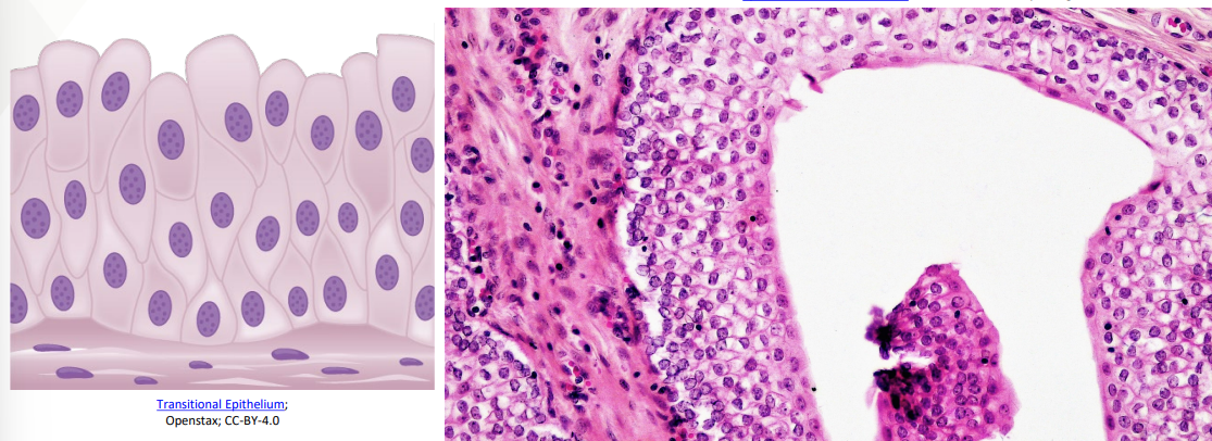 <p>Cells vary from flat (squamous) to cuboidal</p><p>Allows for change and shape of the tissue and to tighten or stretch </p><p>Lines the urinary bladder, parts of the ureters and urethra</p>