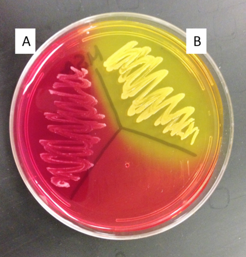Which organism on this MSA plate is a mannitol fermenter?