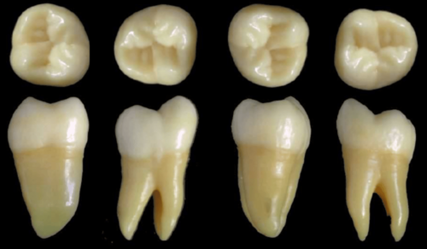 <p>what tooth is this &amp; why?</p>