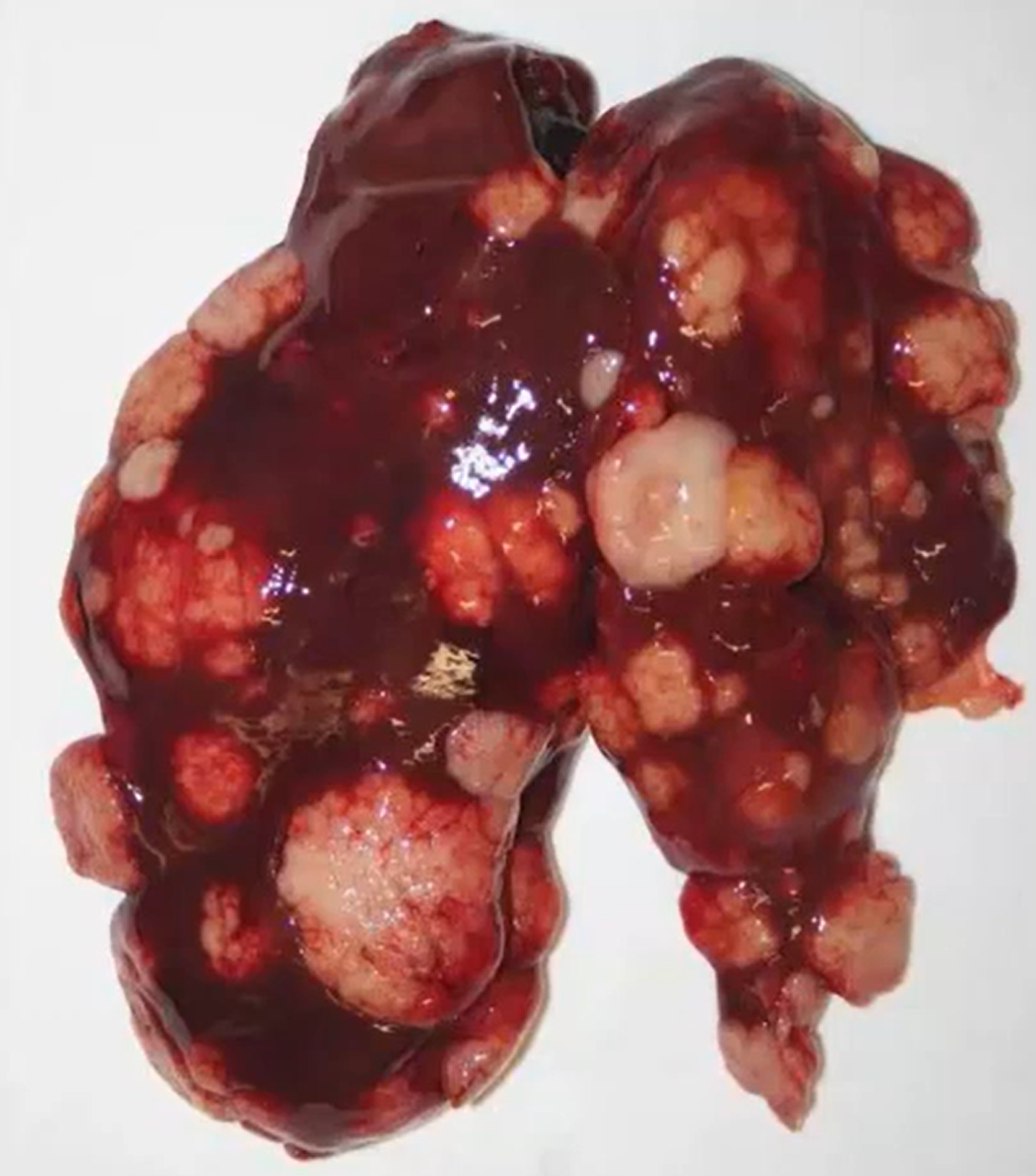 <p>Chicken. MDX and 3 possible causes. </p>
