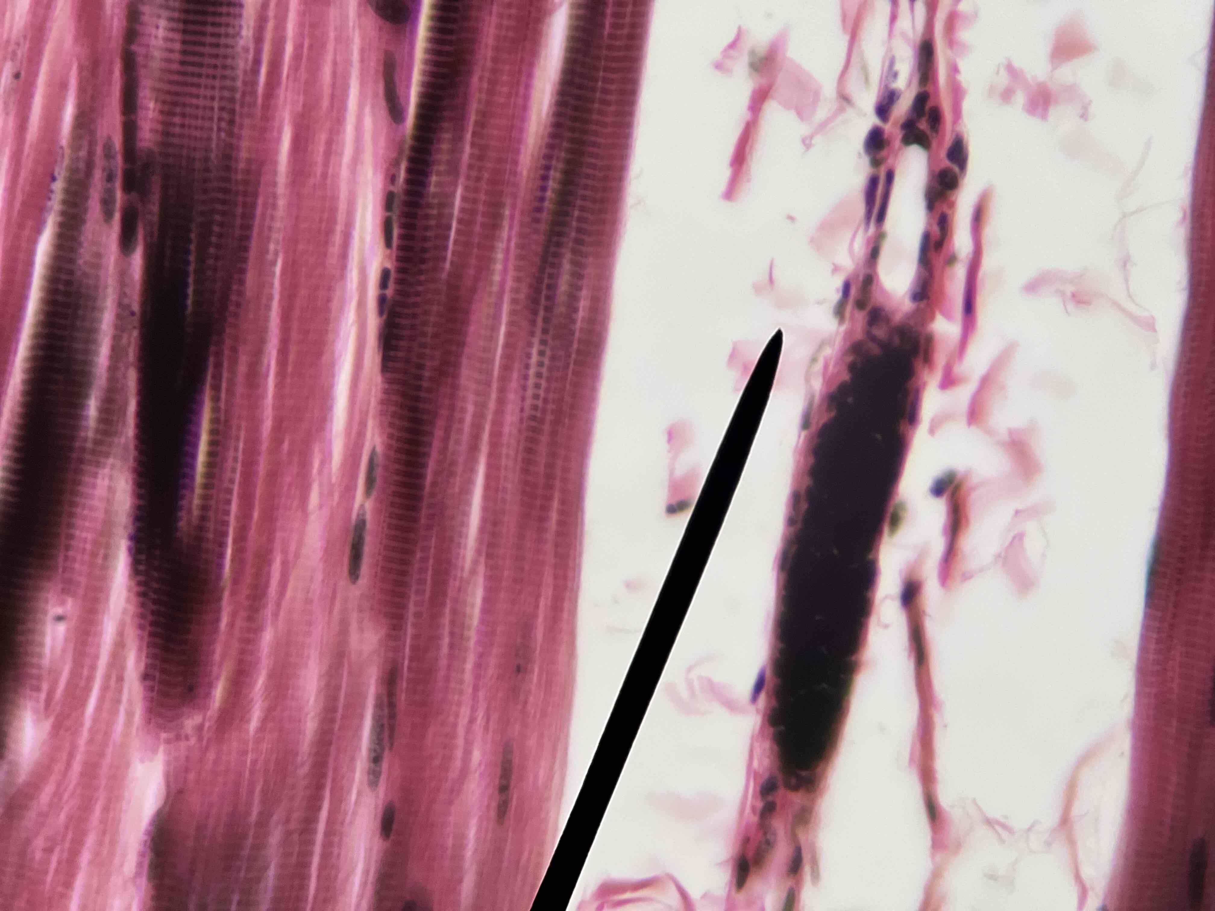 term image