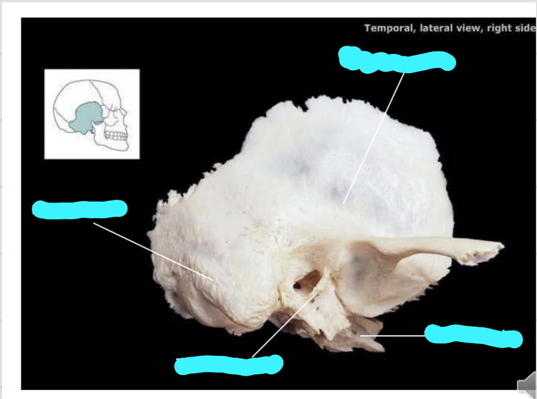 <p>what are the 4 regions of the temporal bone?</p>