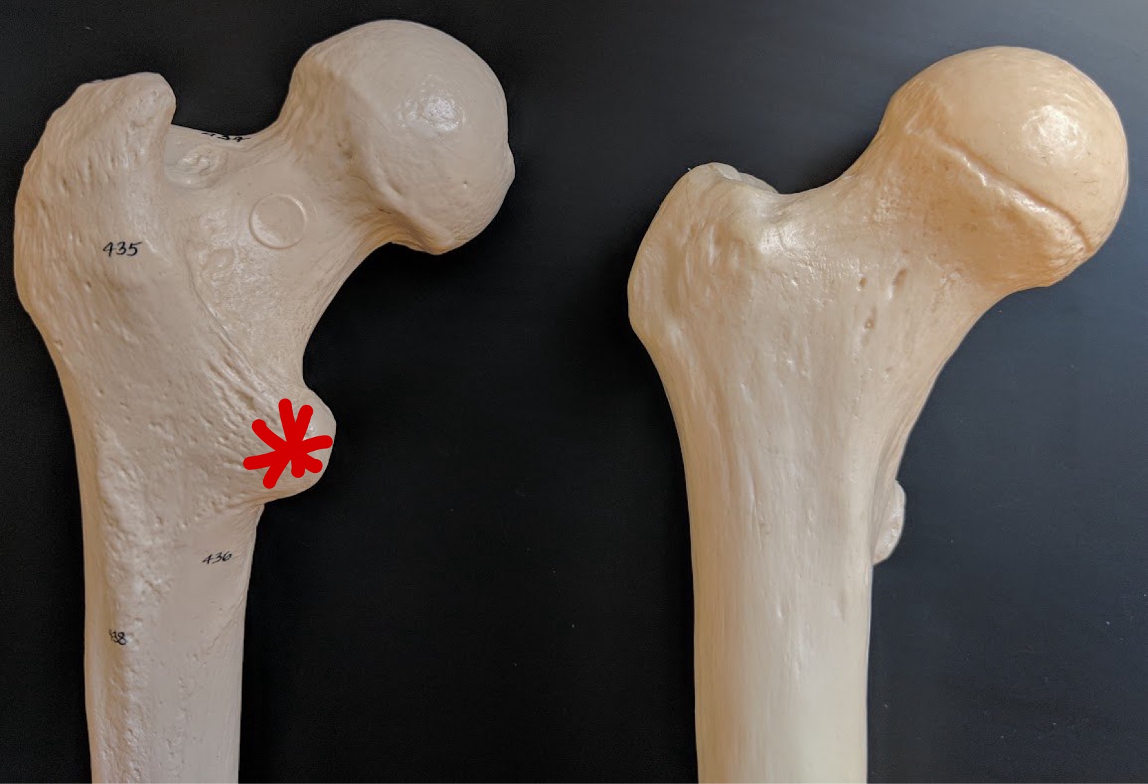 <p>Name this structure</p>