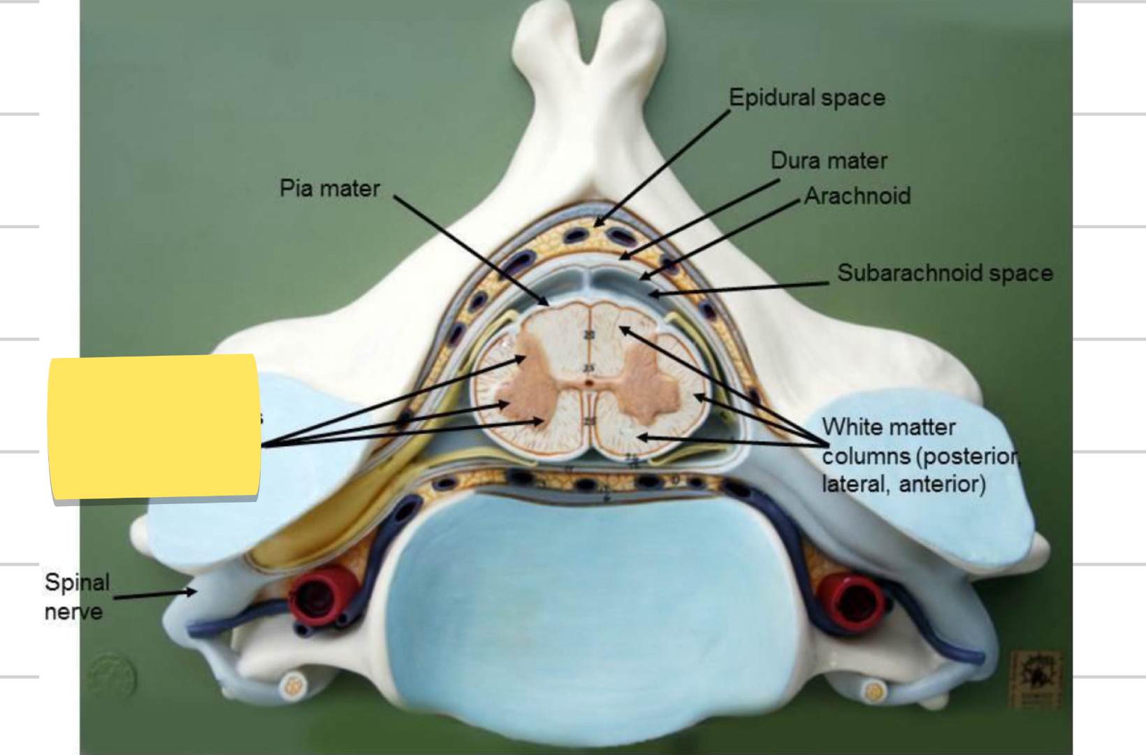 <p>Name this spinal cord part</p>