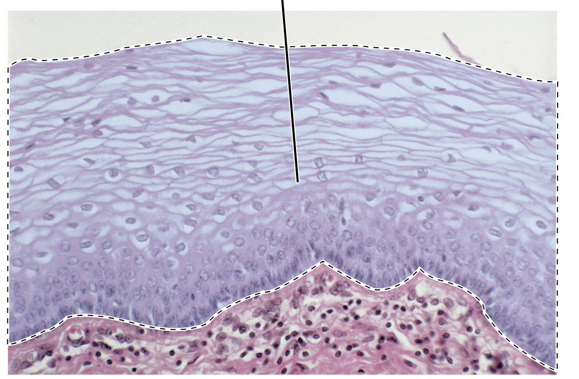 <p>Name the highlighted tissue.</p>