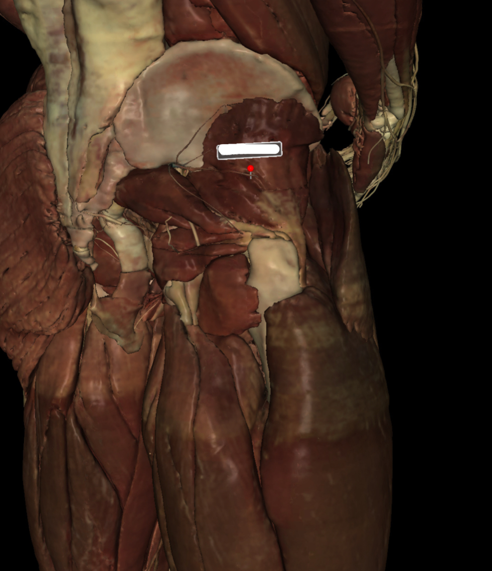 <p>Identify the Structure</p>
