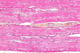 <p>what is the important part in skeletal muscles?</p>