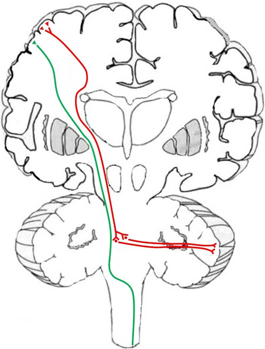 <p>Corticopontine tract, part of the corticopontocerebellar pathway.</p>