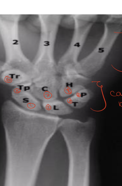 <p>Identify the structures ? view? what joint ?</p>