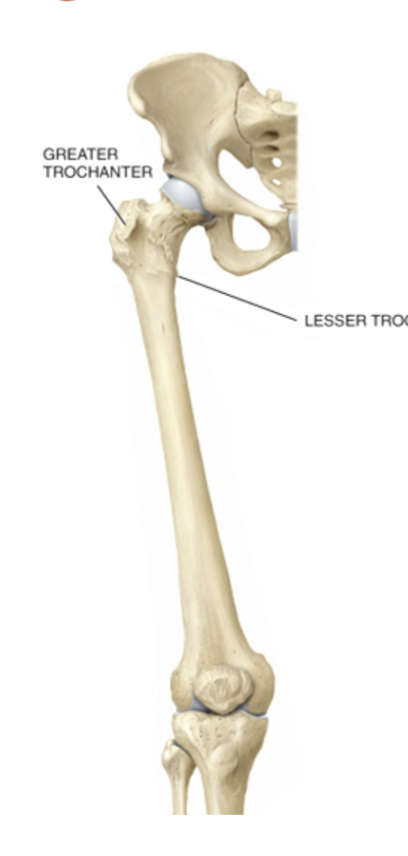 <p>Trochanter</p>