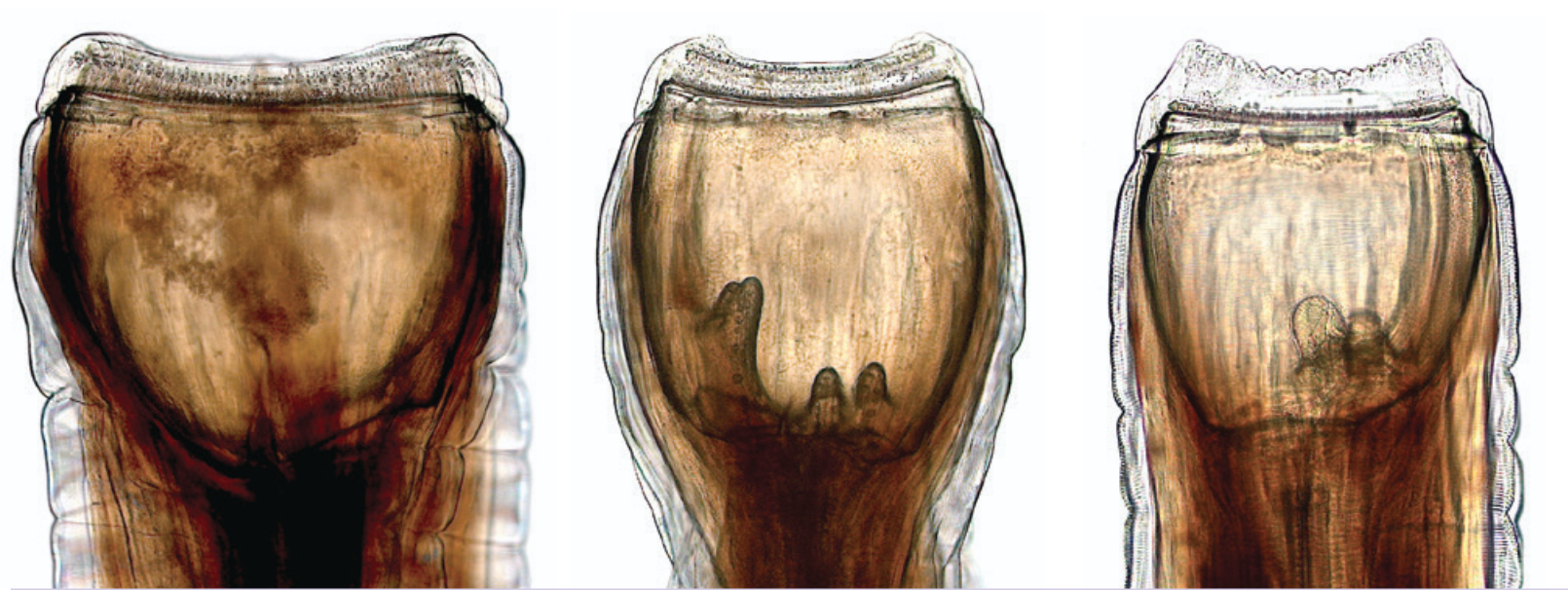 <p>Which is the correct order of Strongylus sp. seen in this photo?</p>