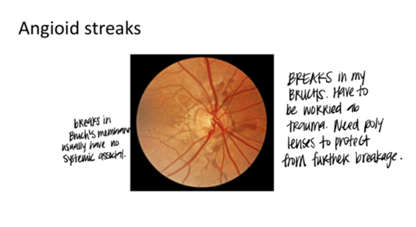 <p>EXAM QUESTION: What are the systemic associations with Angioid streaks?</p>