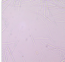 <ul><li><p>Neutral ~ slightly alkaline urine</p></li><li><p>From anti-viral medication for herpes</p></li></ul><p></p>