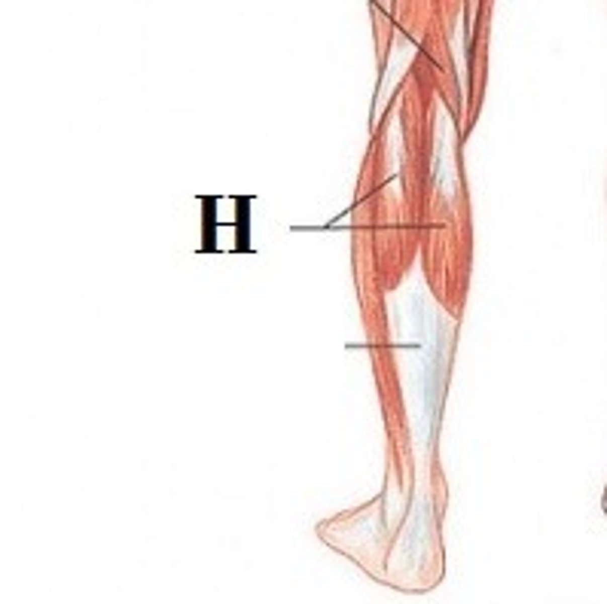 <p>DEFINITION</p>