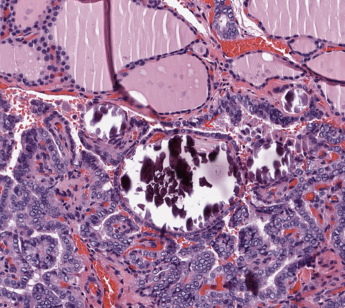 <p>Thyroid</p>