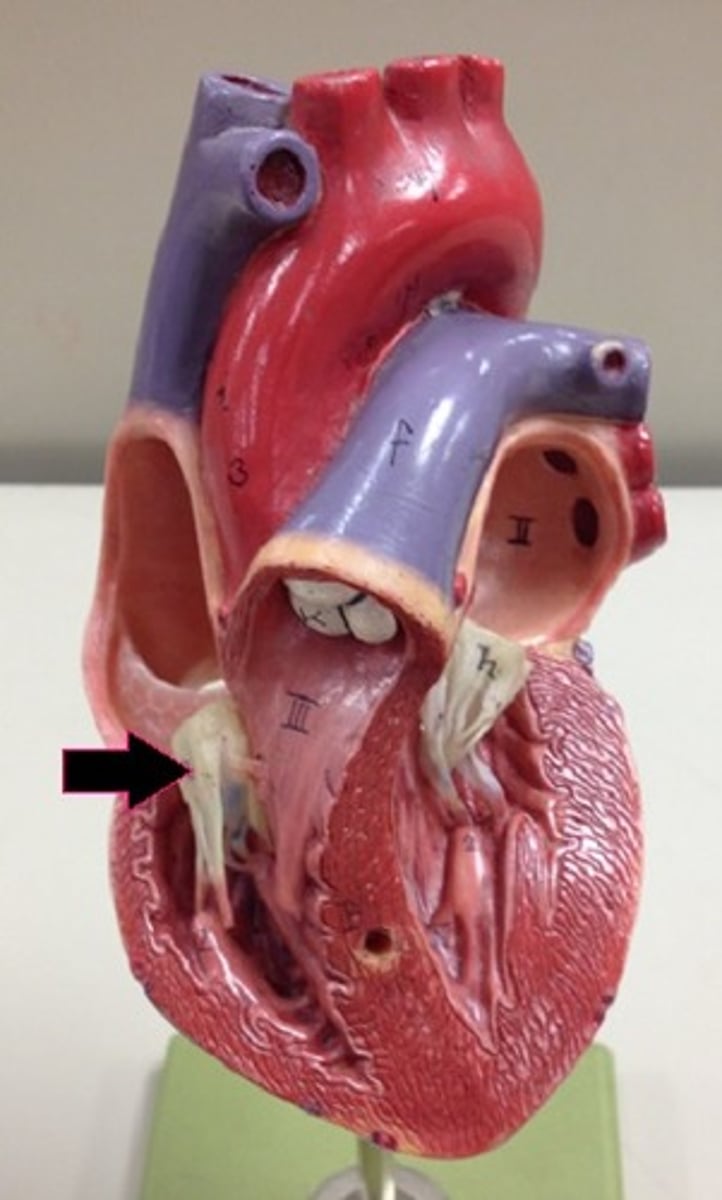 <p>Identify the valve.</p>