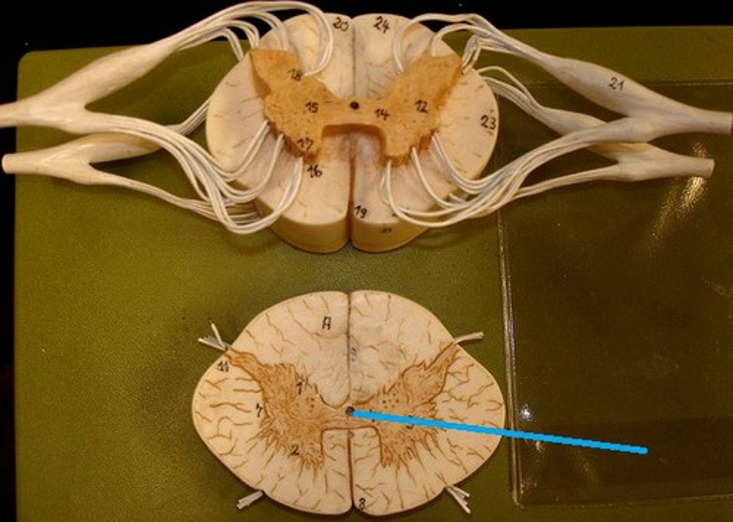 <p>Central canal filled with cerebrospinal fluid (CSF)</p>