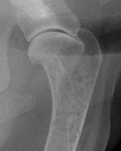 <p>What type of joint is shown in this radiograph?</p>
