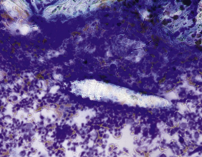 term image