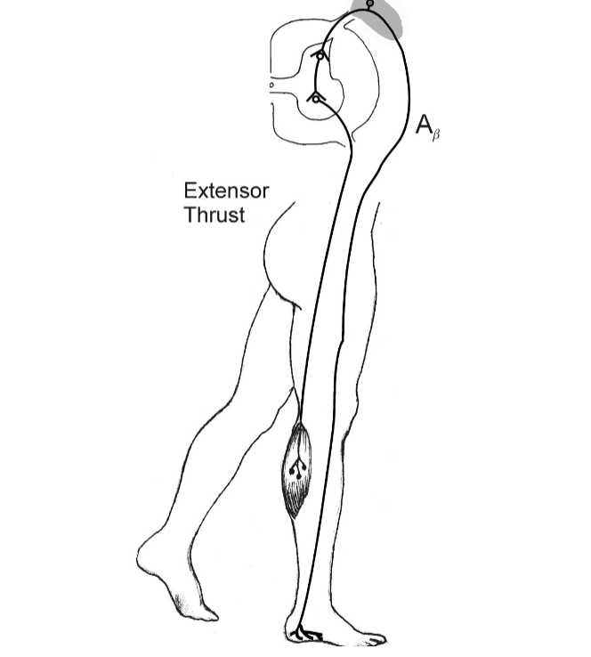 <p>Explain the act of the extensor thrust reflex.</p>