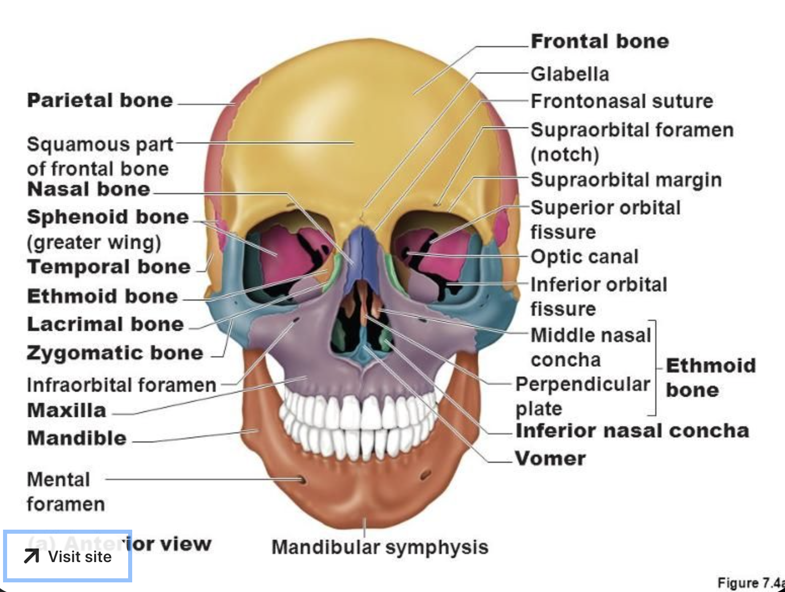 <ul><li><p><strong>Inferior orbital fissure</strong></p><p></p></li></ul><p></p>