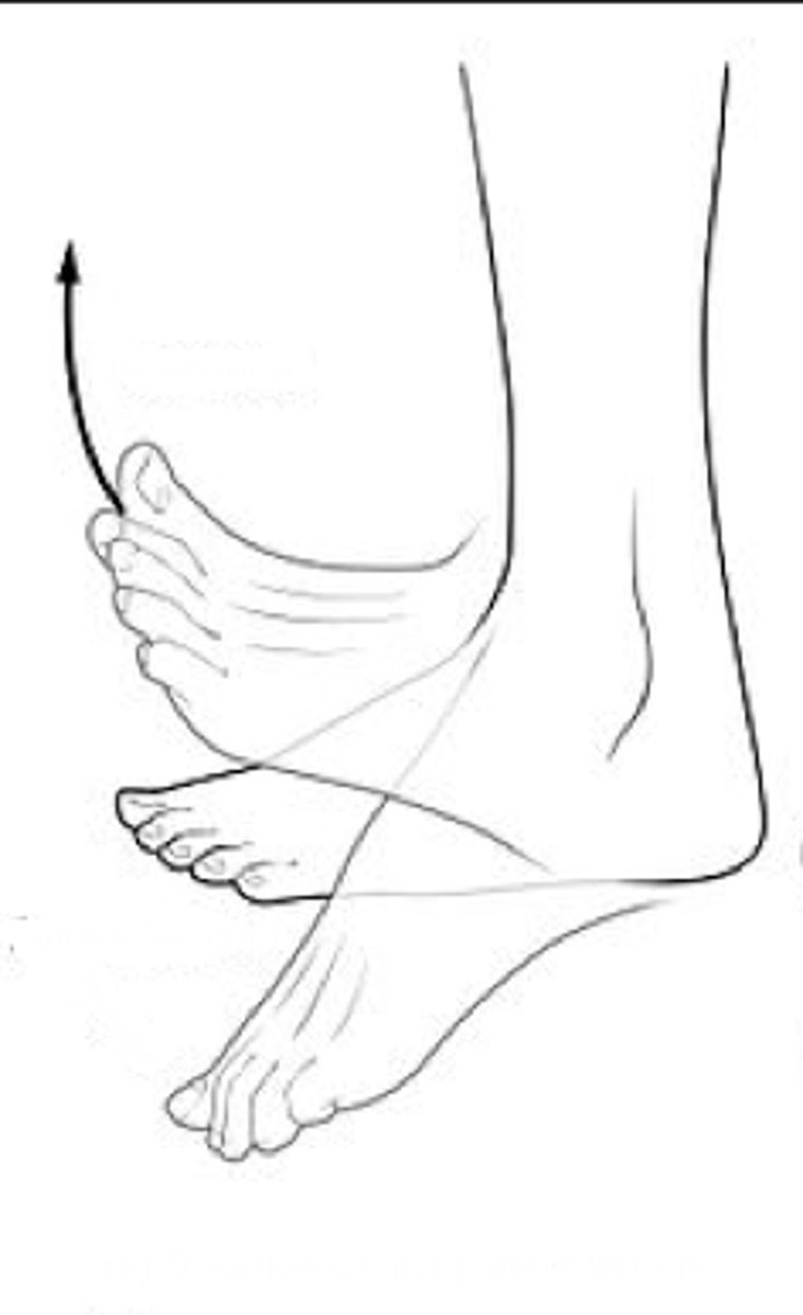 <p>Identify the action indicated in "A"</p>