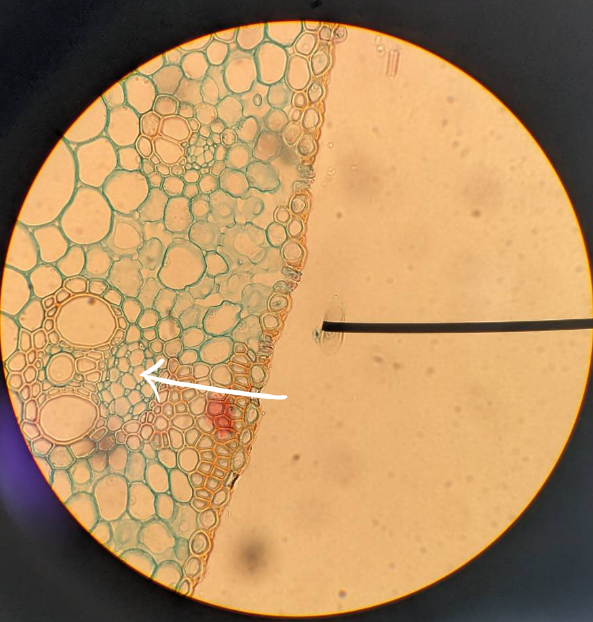 <p>Ignoring the white arrow and looking at the vascular bundle, what type of schlerenchyma surrounds the xylem and phloem </p>