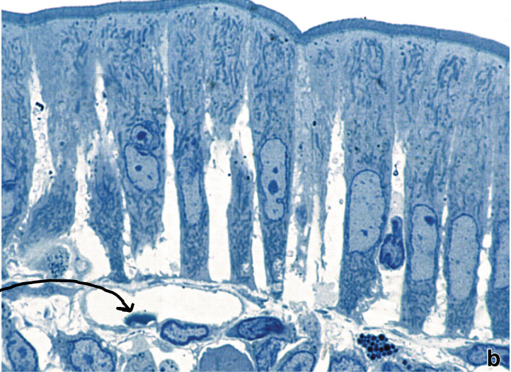 <p>What type of cell is the arrow pointing to?</p>