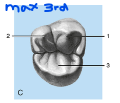 <p><strong>Maxillary 3rd molars typically have 3 major lobes</strong>:</p><ul><li><p>Mesiobuccal lobe</p></li><li><p>Distobuccal lobe</p></li><li><p>Mesiolingual lobe</p></li></ul><p>The distolingual lobe is often underdeveloped or absent.</p><p>Max 3rd molars can be unpredictable in size and shape. </p>