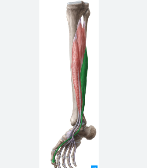 term image