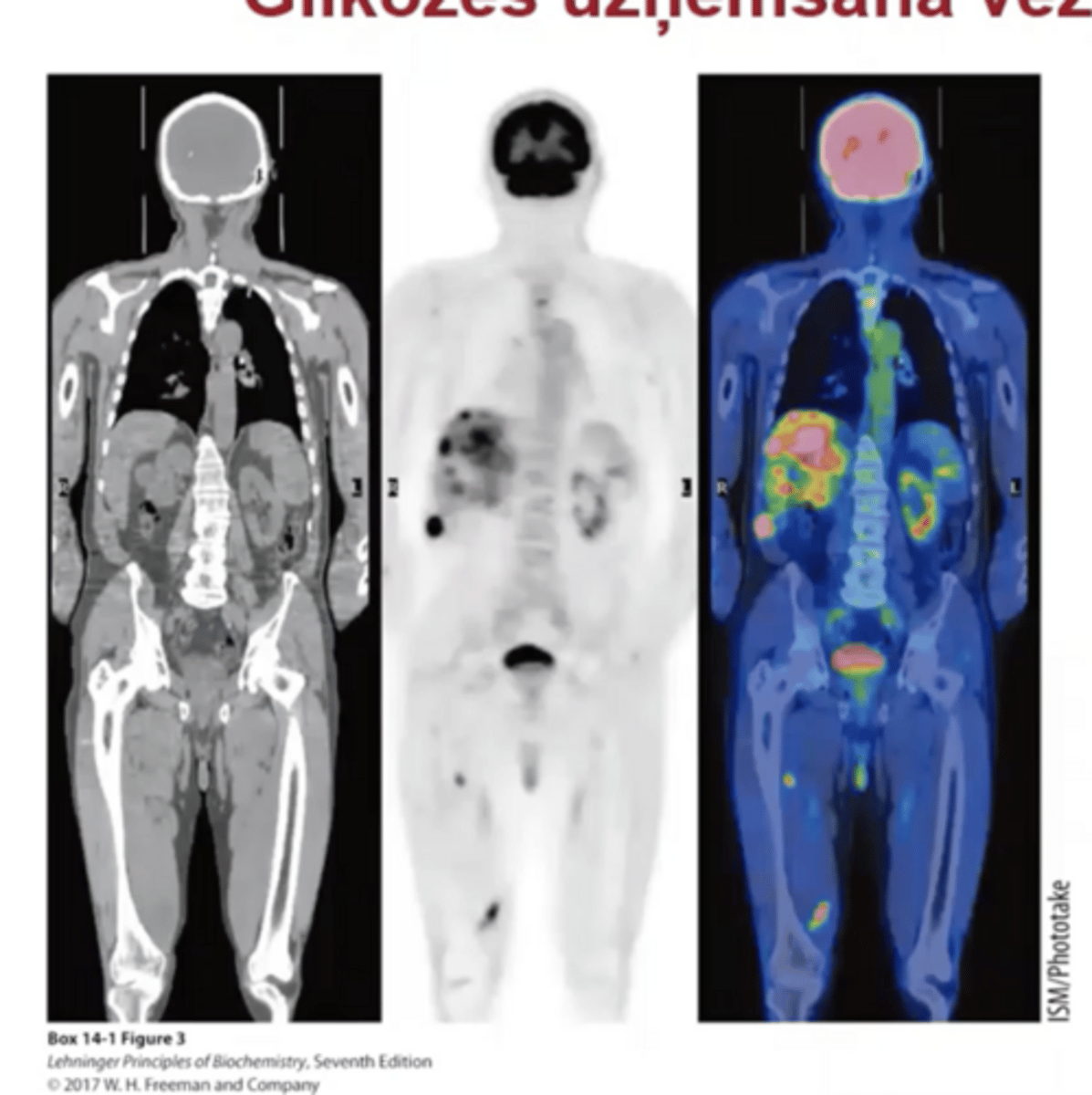 <p>nosaka ar izotopu iezīmētu glikozes analogu ko uzņem, bet nespēj metabolizēt audi.</p><p>iezīmē glikozi (Fluorīda), un tad var redzēt kur vairāk uzkrājās- jo vēža šūnas patērē vairāk</p>