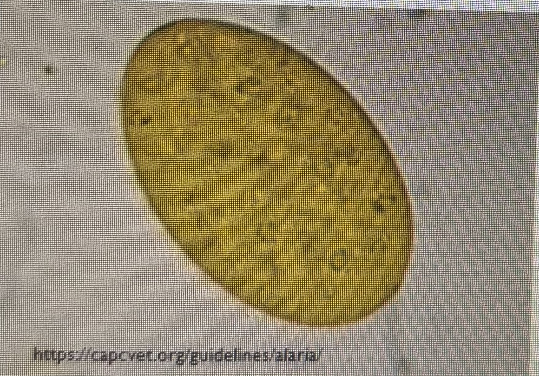 <p>Intestinal flukes of dogs and cats</p><p>Found throughout North America</p><p>Dog or cat eats an infected frog snake or mouse</p><p>Ova are large, golden brown and operculated</p>