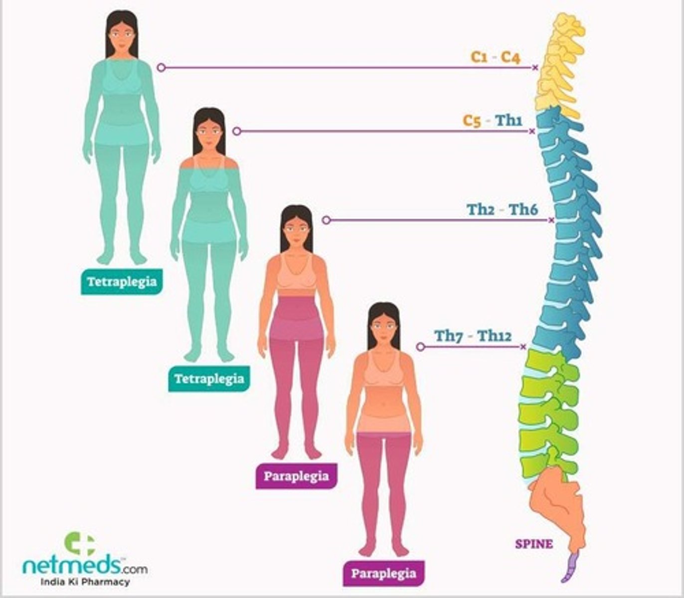 <p>Complete or partial loss of sensation and/or movement in all four extremities and torso.</p>