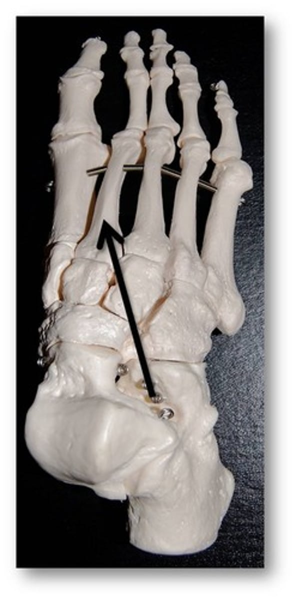 <p>Name this specific bone of the foot.</p>